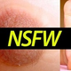 Illustration for article titled Woman Grows Full Size Nipple On Foot